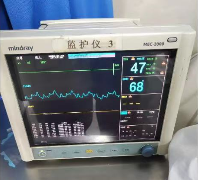 邁瑞監(jiān)護儀MEC2000恢復出廠設置的具體步驟和注意事項