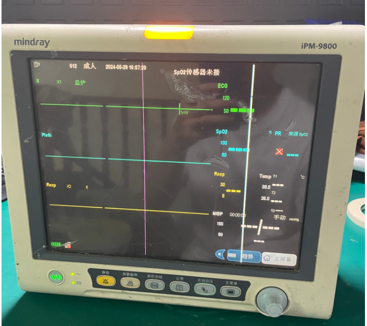 邁瑞PM9800監(jiān)護(hù)儀電池更換操作指南與注意事項(xiàng)